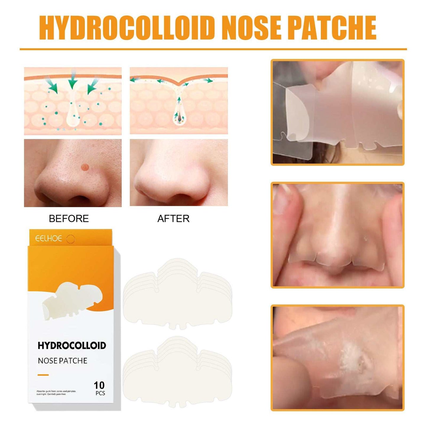Hydrocolloid nose stick clean pore peel patches with before and after results, 10 pcs box