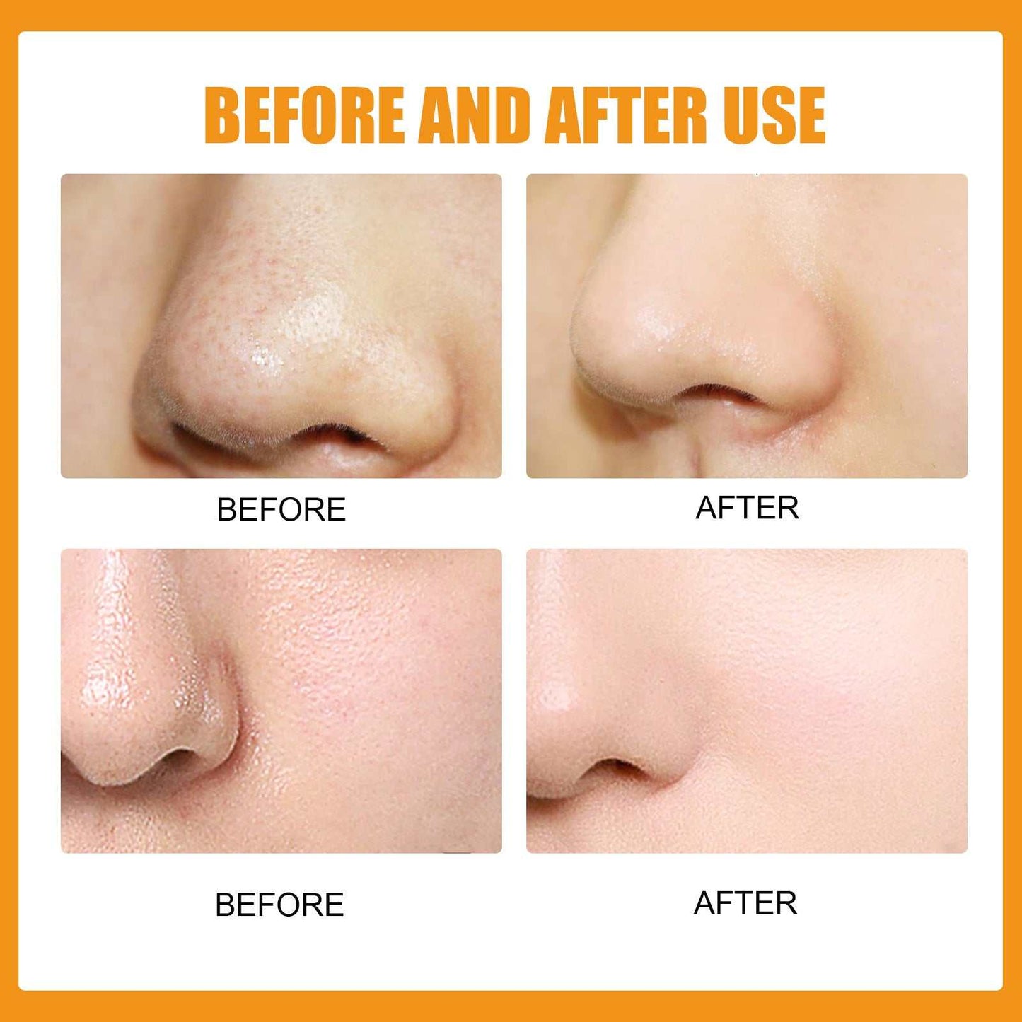 Before and after use of Nose Stick Clean showing clearer and smoother nose pores.